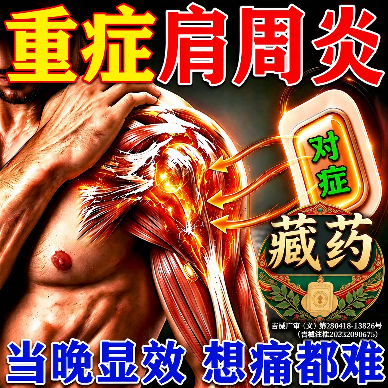 一贴好【重度肩周疼】治肩周炎药
