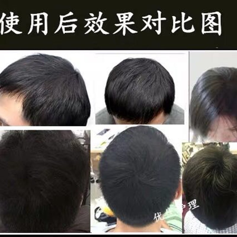 密发增发纤维粉头发变浓密遮秃头顶填充粉补发神器假发美发粉喷雾