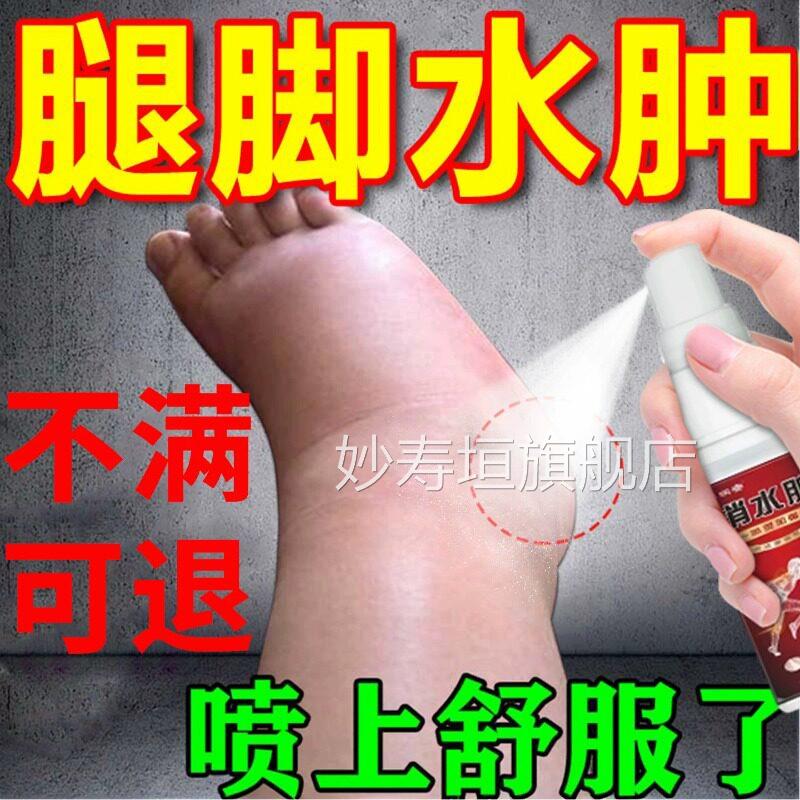 去老人下肢水肿脚肿消肿专用浮肿老人活血化水瘀止痛利利尿排贴膏