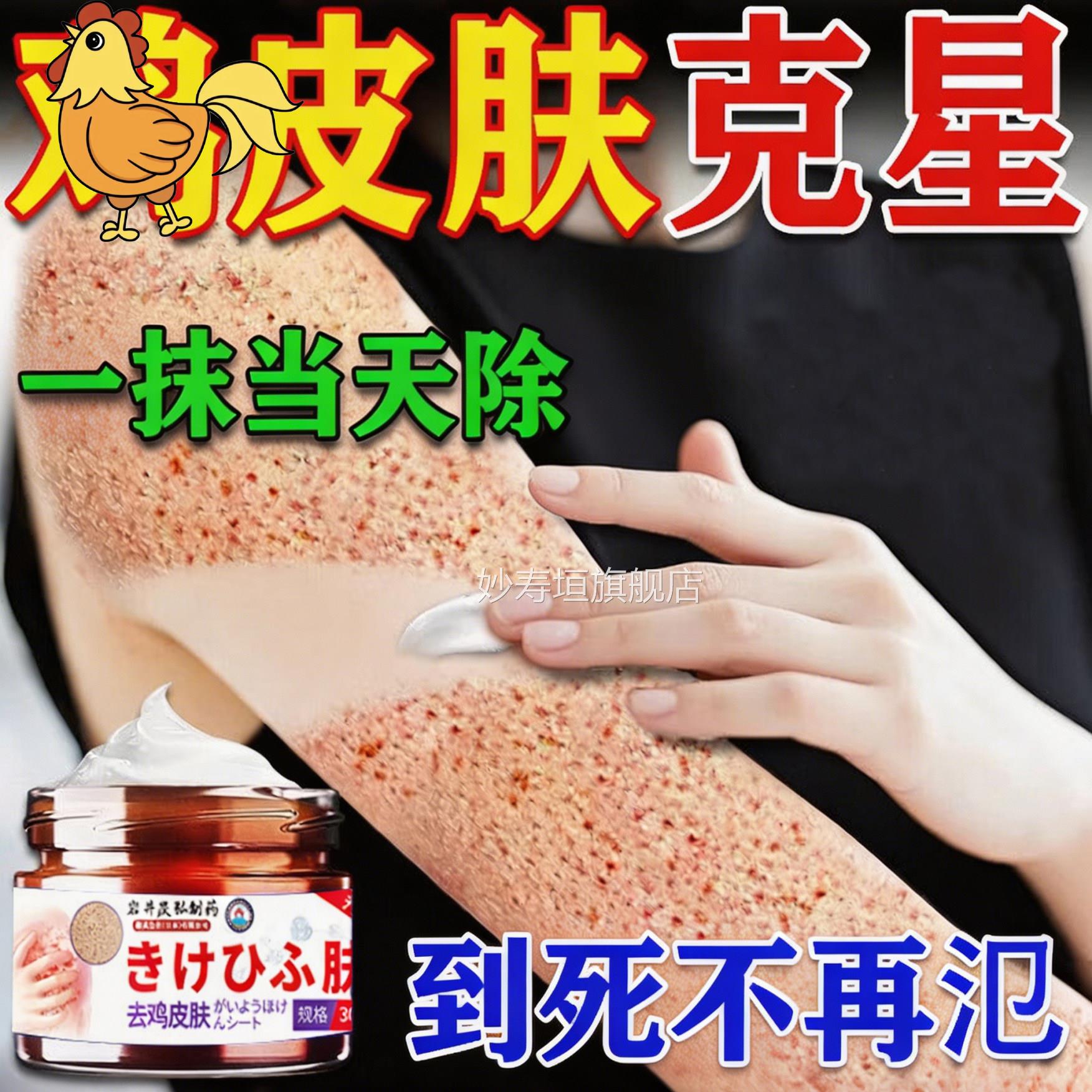 鸡肤皮疙瘩毛囊角专化症用去全除身臂腿背毛孔部堵塞疏神器通膏药