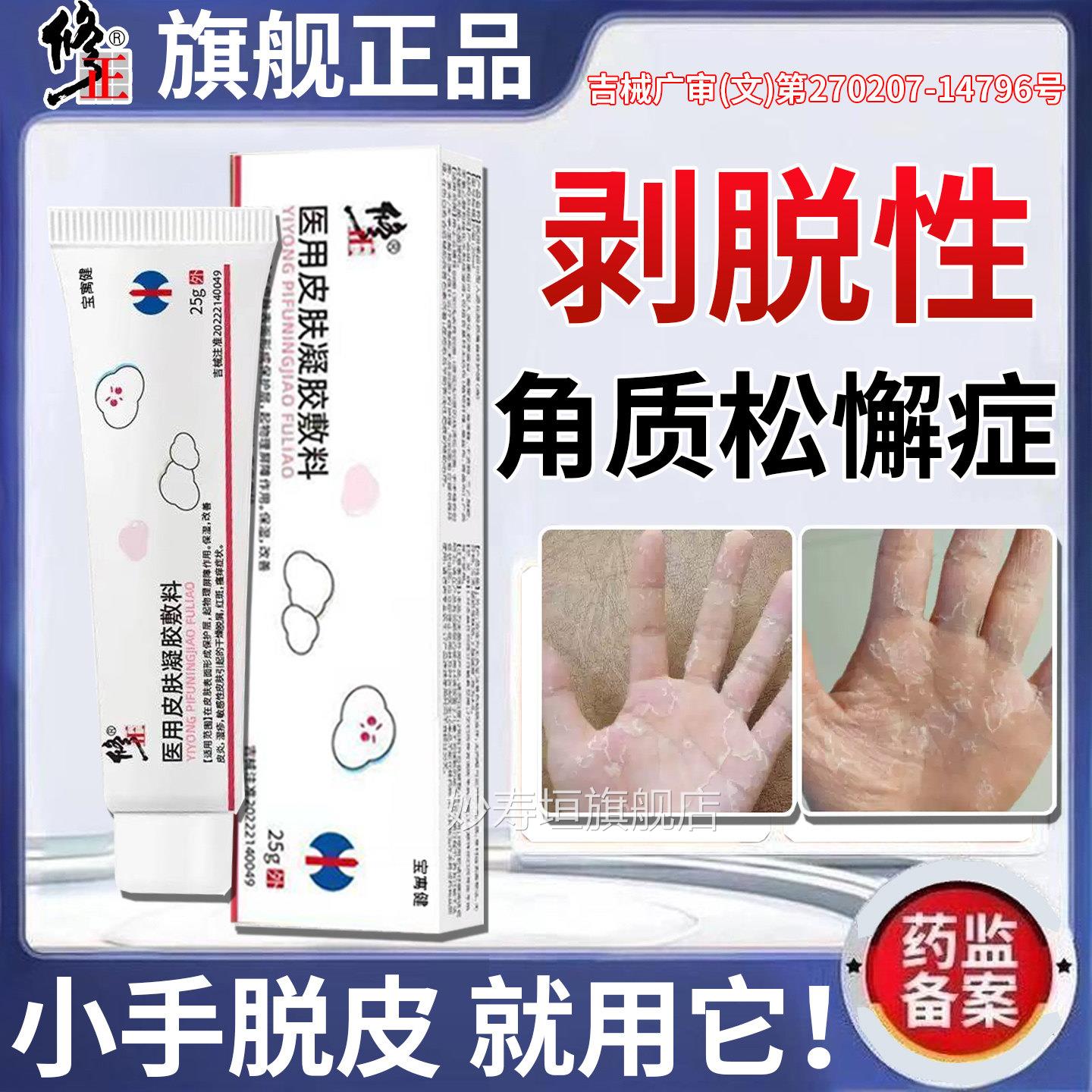 剥脱性角质松懈症儿皮童手脱严重松解专用手脚真菌手指干燥起皮膏