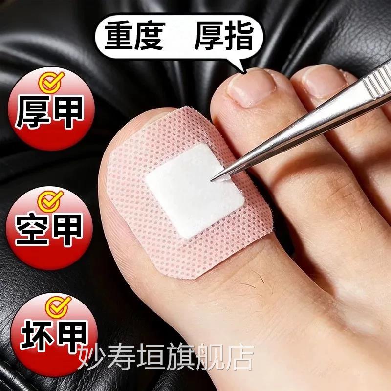 【断货王】灰增趾厚正品专用灰指贴发黄粉碎甲脚趾手指甲专用妙寿