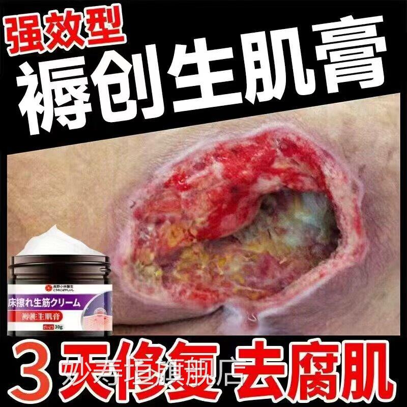 臀褥创膏老人部外用伤口祛腐损伤老烂腿压疮膏贴日本快速愈和正品