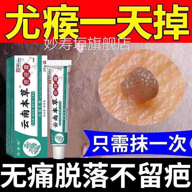 云南本草克疣膏去疣药水尤脖瘊子小肉粒扁平疣去除软神膏一抹灵器
