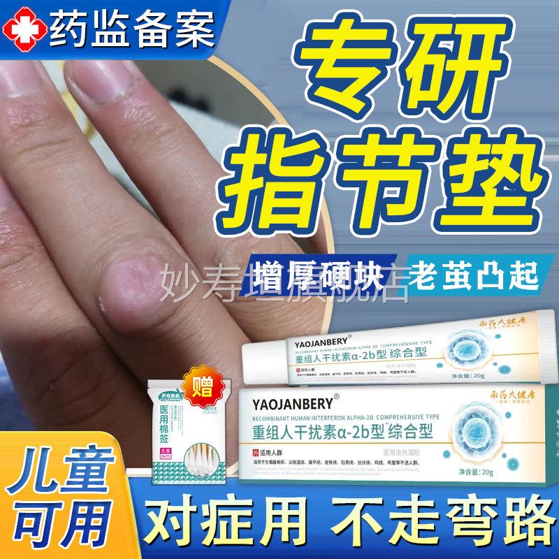 指节垫药膏化手指关节茧硬皮手上长硬疙瘩癣软瘙痒角质增厚儿童TT