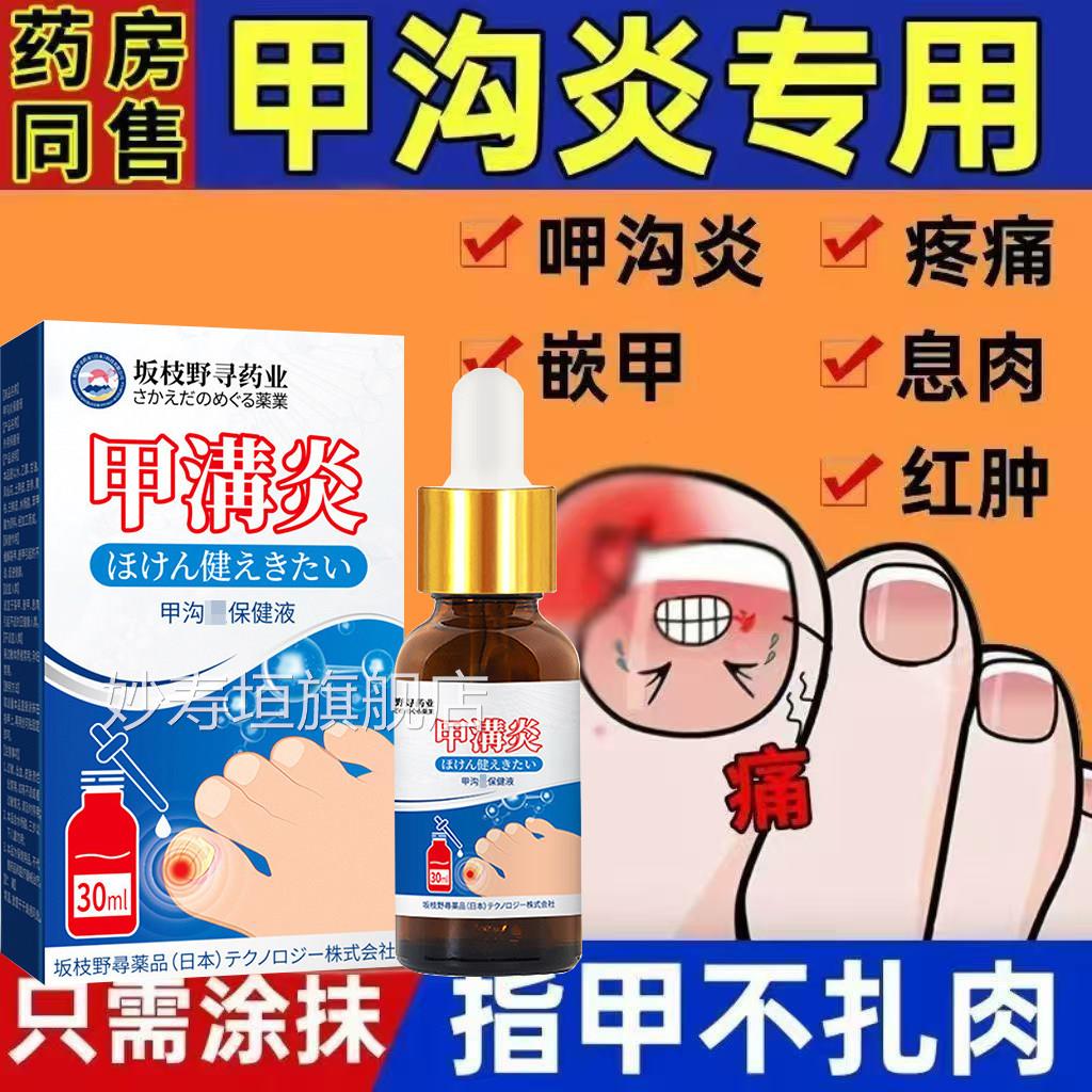 甲夹沟炎辅助治疗专用效特大药房器神脚趾克根甲往肉里长手指膏嵌