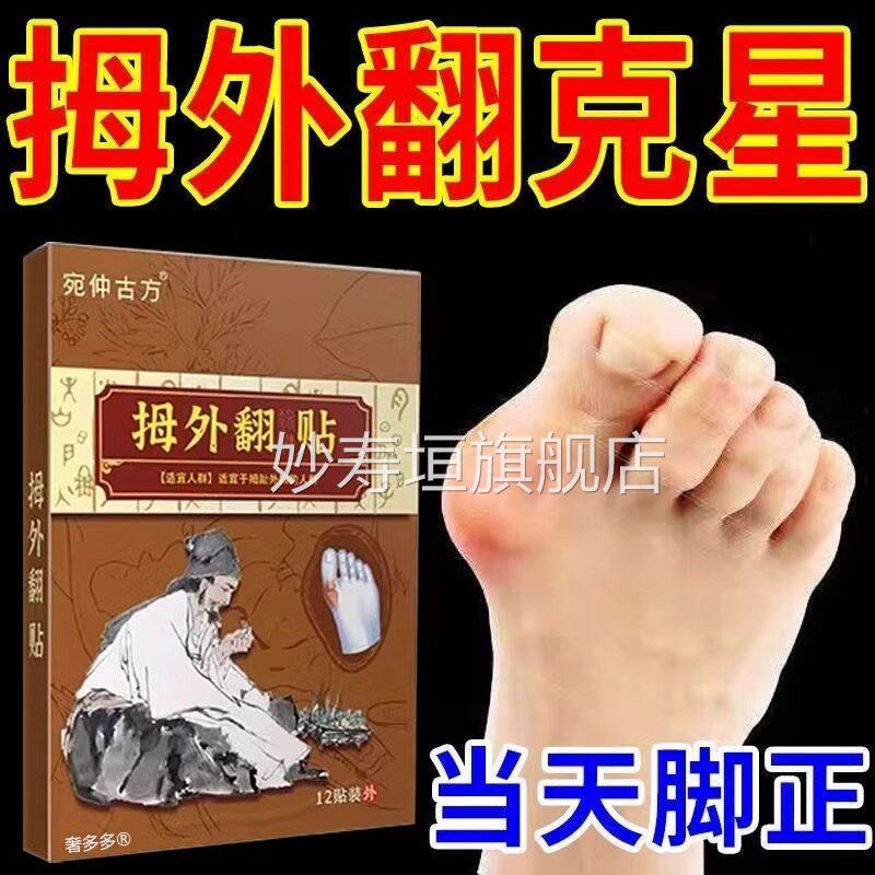 拇指外翻药膏贴拇囊炎疼痛大脚骨脚趾畸形肿矫正胀神器女克星神器