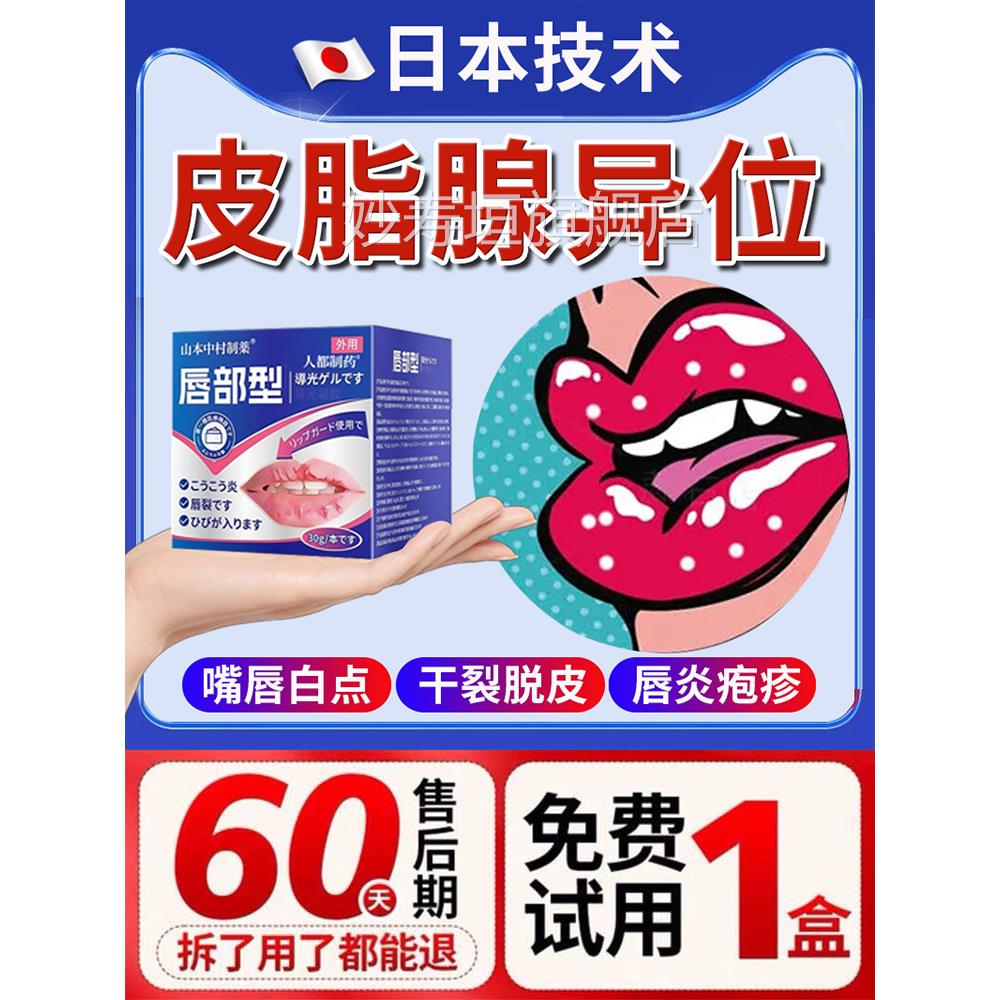 皮脂腺异位颗症嘴唇白点脂肪小粒去除神器唇炎口角炎烂嘴角非药膏