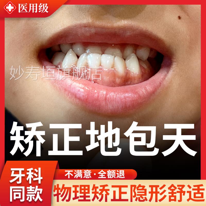 地包天矫正神器儿正童成人改善嘴凸下巴后缩牙齿纠专用牵引矫正器