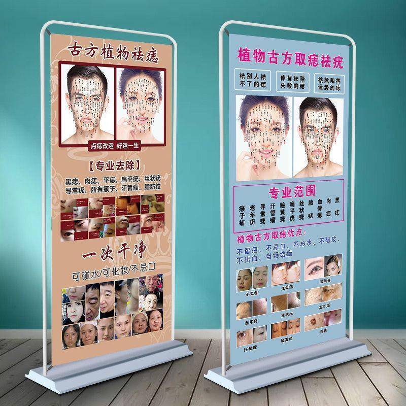 男女面痣图点痣图片面痣面相去痣海报美容院装饰画广告展架易拉宝