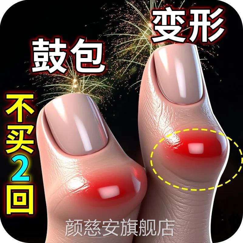 手专指骨关节炎用膏药变形肿大僵硬疼理疗热敷内风湿类关节痛贴膏