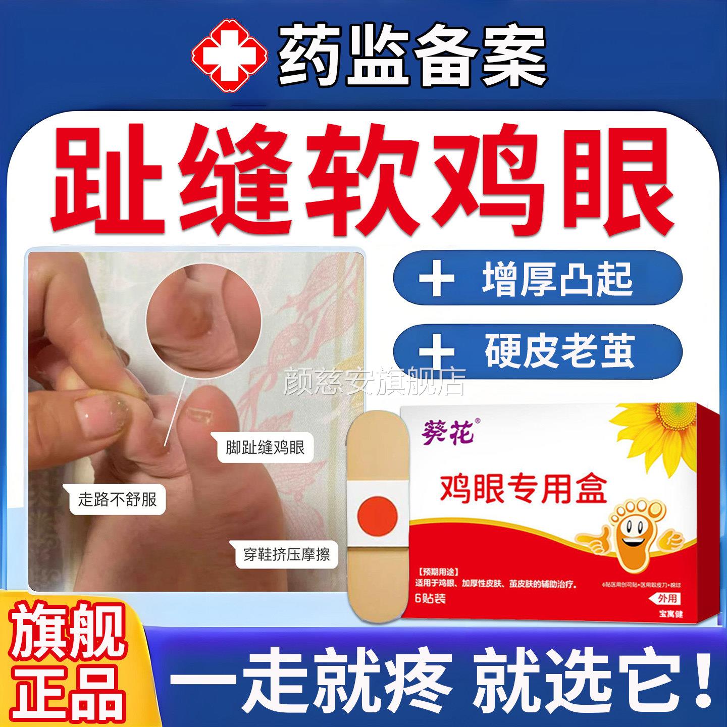 鸡眼贴无除老茧治疗茧皮肤增厚专用官方痛旗舰店正品医用级颜慈安