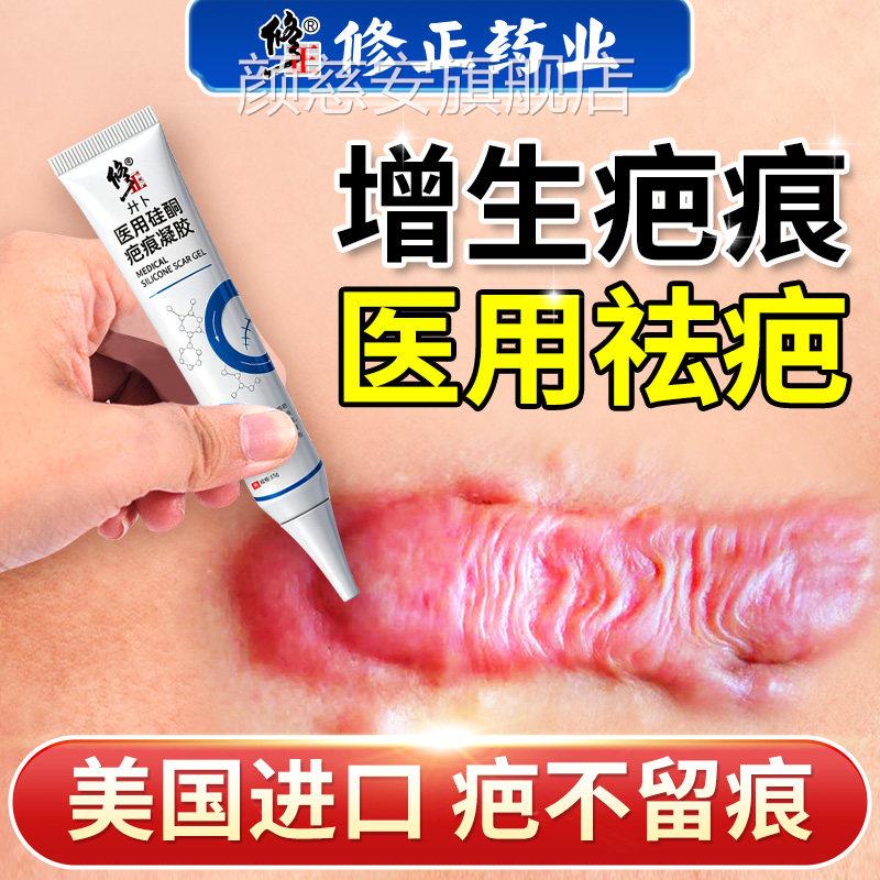 祛疤膏去疤膏除疤痕增用生凸起去除疙瘩修复手术剖腹产医硅酮凝胶