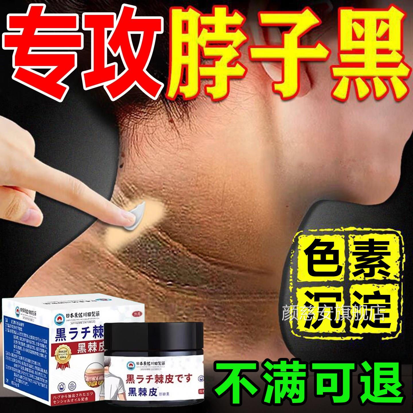 脖子黑色素去除黑棘皮脖色子黑素沉淀洗不干净肥胖神美白器颜慈安