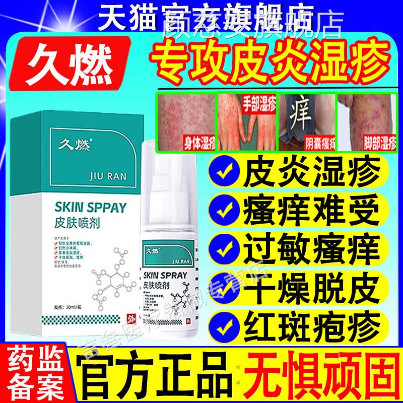 久燃皮肤喷剂皮肤瘙痒皮炎痤疮过敏干痒大腿内侧痒全身痒方官正品