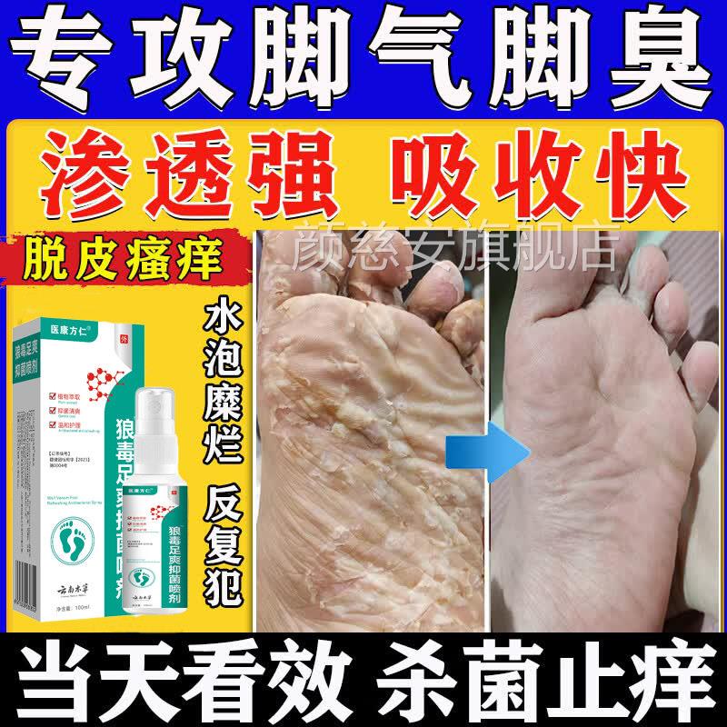 云南本草狼毒足爽正抑菌喷剂祛除脚臭气痒水泡脱皮糜i烂止瘙痒品