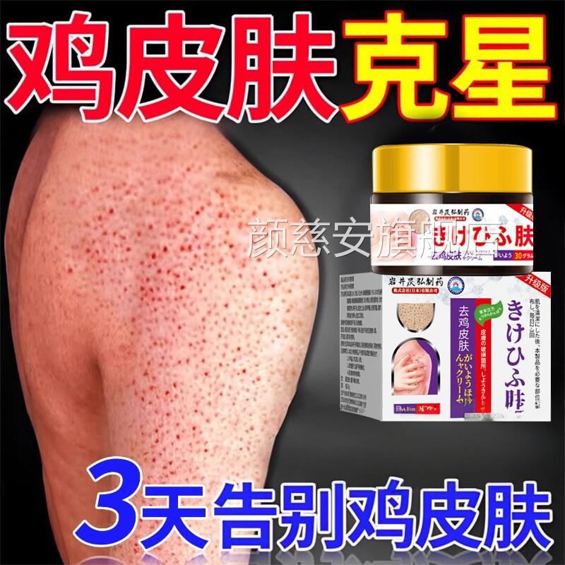 日本鳞去鸡皮肤鱼疙瘩毛囊角化症角质膏用手臂身体去除器永颜慈安