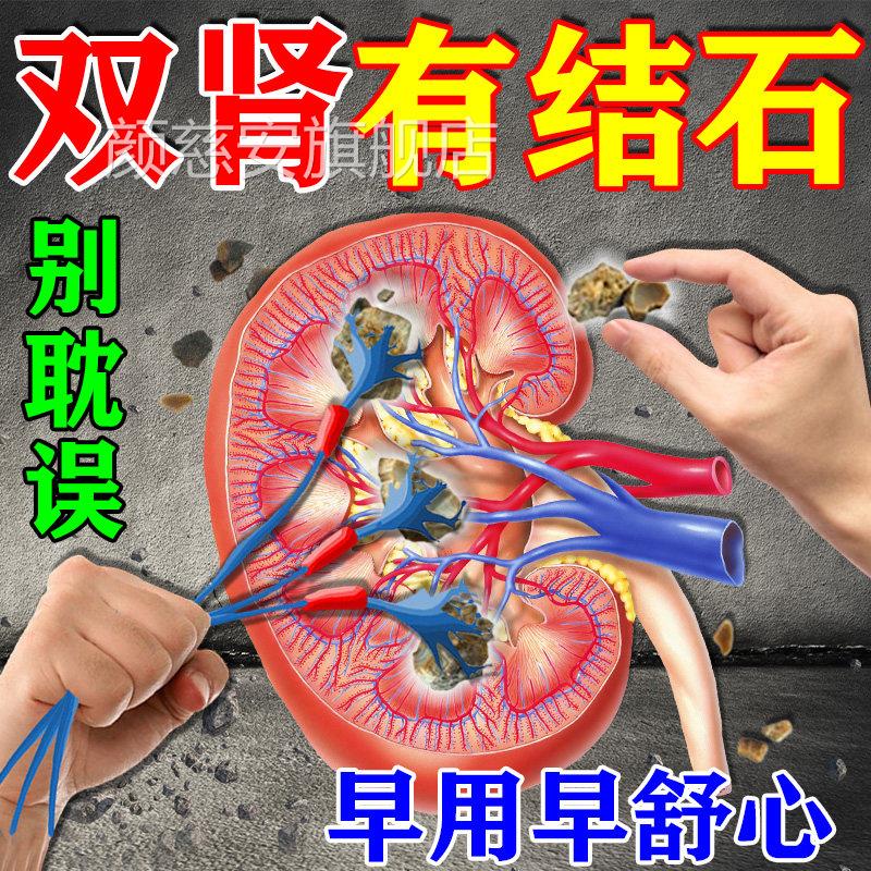 肾结石排石药钱草鸡内金腰疼排尿金疼痛溶化石排石养肝护肾中药贴