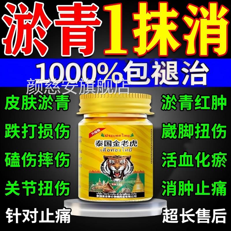 淤青膏快速消除儿童跌打损伤摔活扭撞伤红肿专用发紫血化瘀止痛消