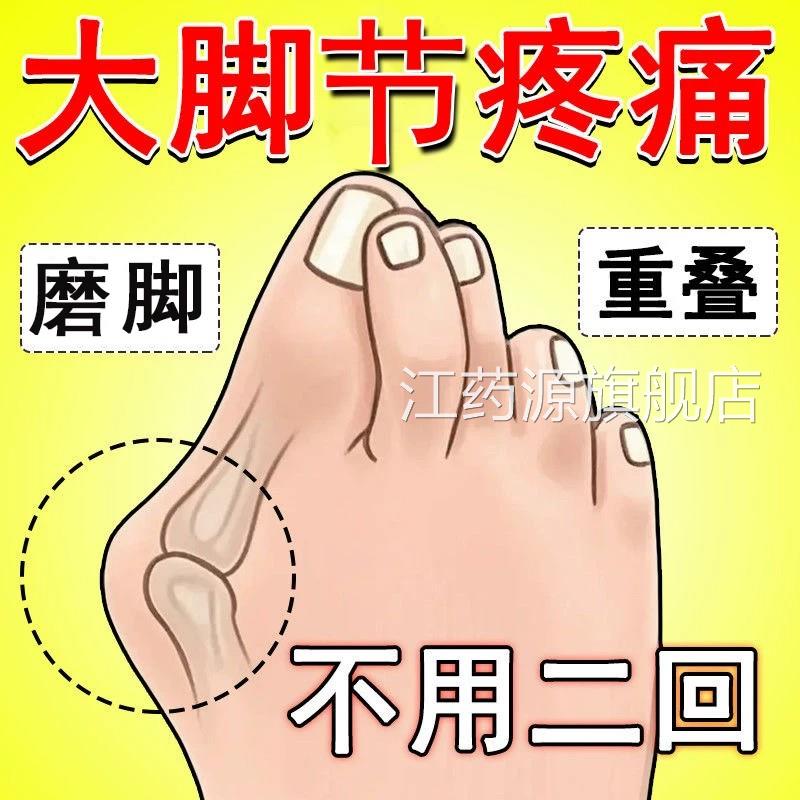 【已愈100w人】拇指外翻突膏药贴专用大脚趾骨外翻出矫正器拇囊炎