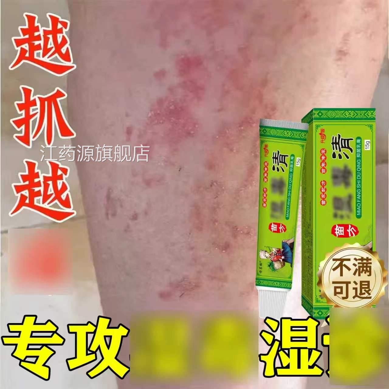 止痒膏湿毒女清私处阴囊软膏瘙痒专用男药膏全身外用旗舰店正品江
