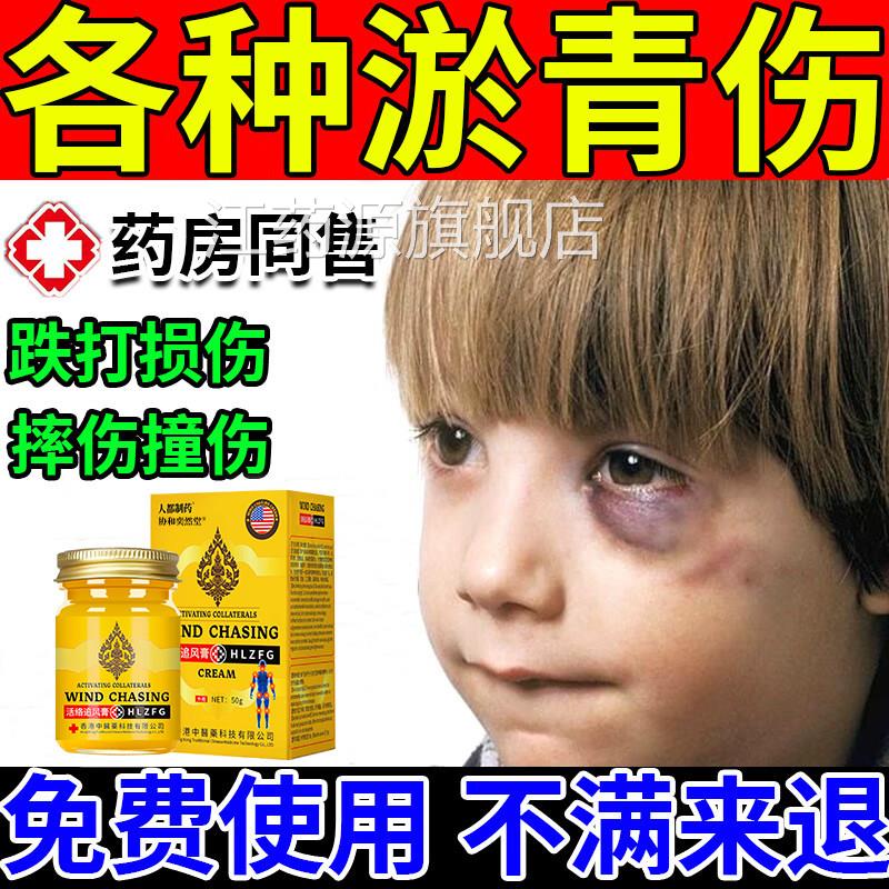 淤青膏快速消除宝宝青膏眼部眼睛活血化瘀去淤青摔淤倒膝盖腿磕碰