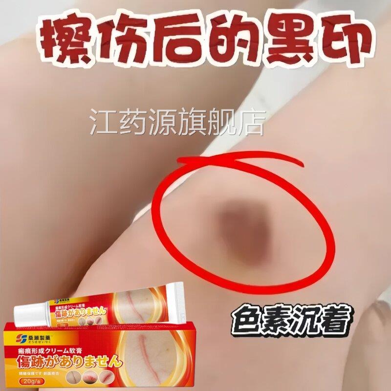 疤痕膏旧疤伤疤淡疤痕修印复凹凸增生痘坑痘印疤痕江药源旗舰店