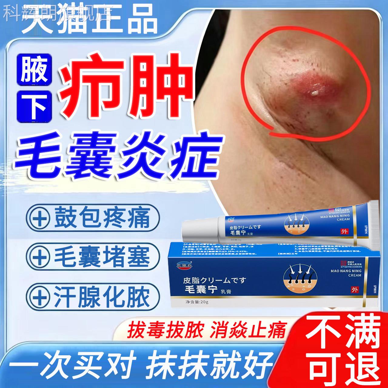 腋下疖肿火疖子拔毒拔脓膏脓包异硬块毛囊炎真菌感染疼痛瘙痒味A