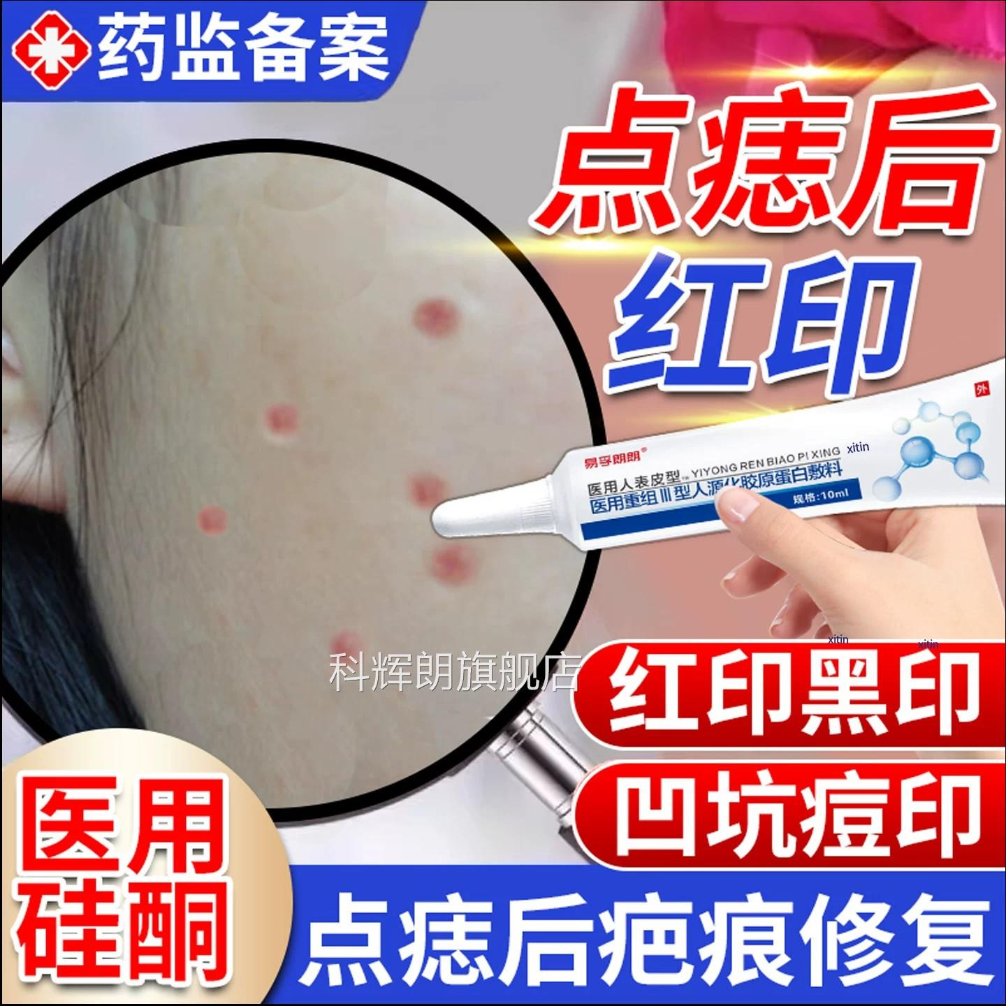 激光点斑祛痣点后去红印修复膏退红淡印液去痣痣凹陷疤痕专用科辉