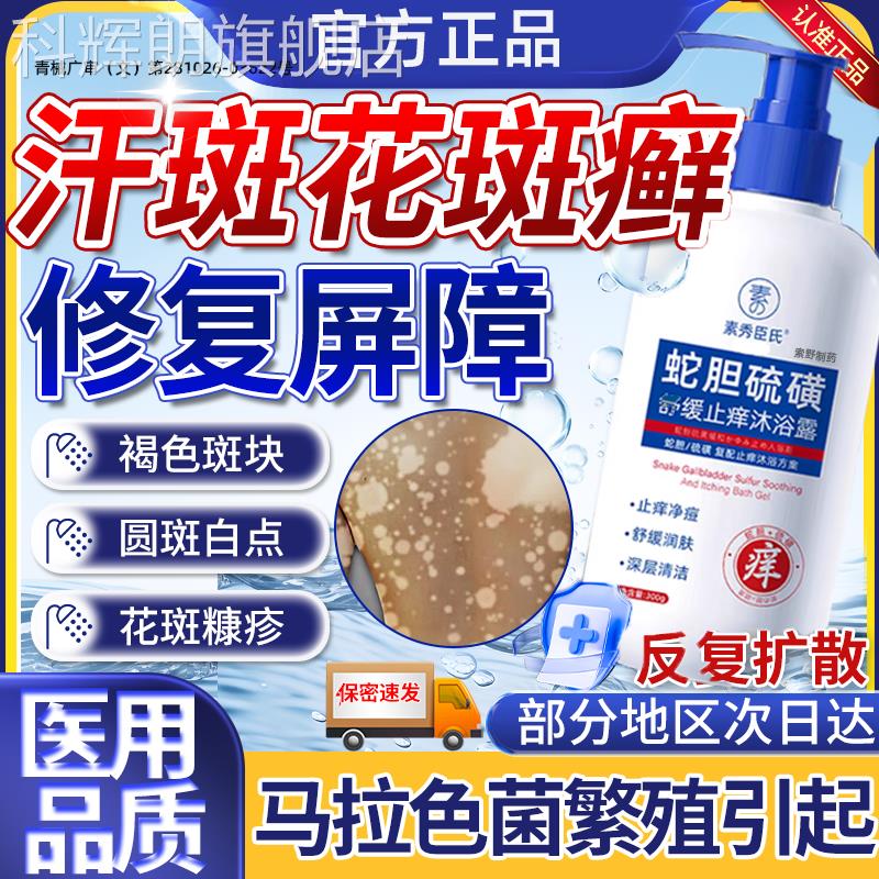 汗斑花斑癣专用沐浴露洗剂马拉菌感染玫瑰糠色疹手足药房同售XH科