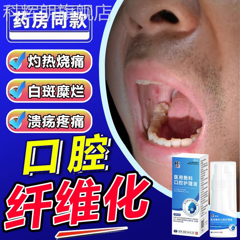 槟榔口腔黏膜纤嚼维化专用溃疡白斑修复液黏膜扁平苔藓药房同售QQ