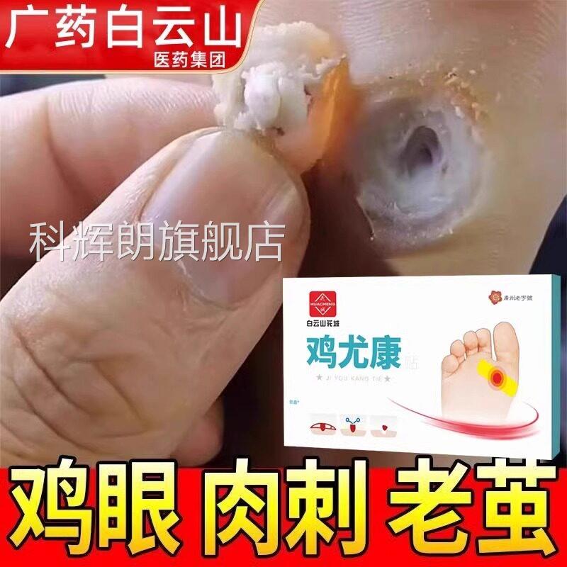 白云山鸡眼药膏贴部瘊子手足护理去脚底脚趾跖疣灵老茧根肉刺死皮