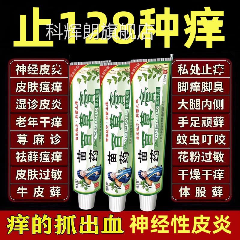 顽皮神藓治牛皮癣银屑病皮肤去湿疹止瘙痒根特经性皮炎专外用膏疗