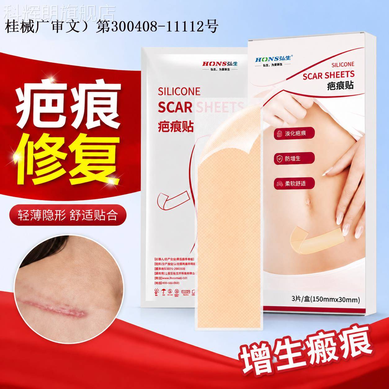 瘢痕贴增生凸起去除疙瘩医用硅酮修复疤痕除疤前甲胸状术后剖腹产