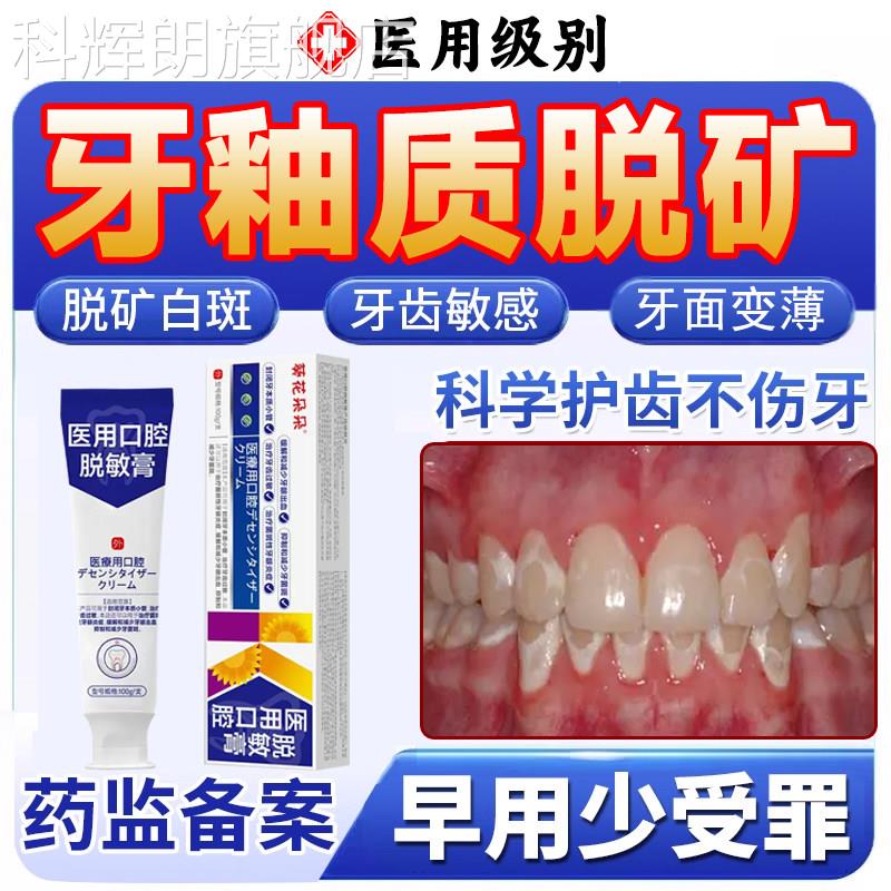 牙齿敏感酸痛脱矿抗过敏修覆牙釉损伤质可搭补矿含氟牙膏使用TO科