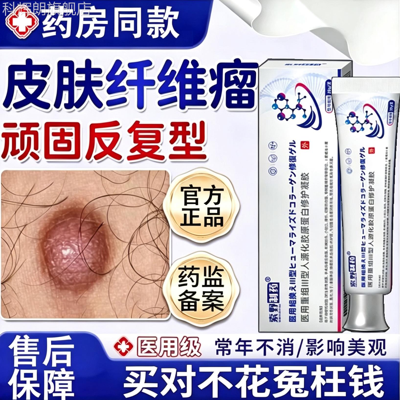 医用皮肤纤维瘤去除药膏皮下结硬疙瘩脂肪瘤消瘤肿硬块节贴JX科辉