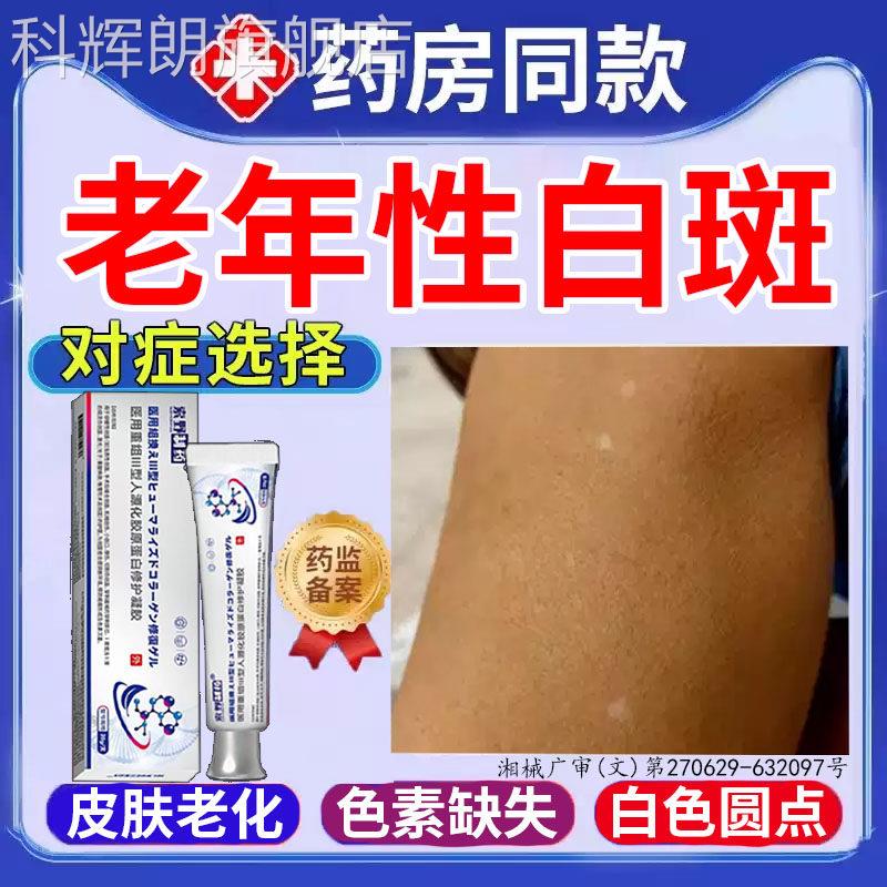 老年性白斑皮肤褐斑老年斑去凝胶专用手背部脸部白点药房黄同售TK