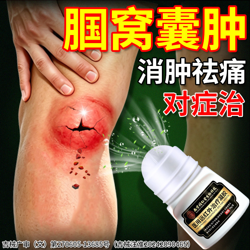南京同仁堂【腘窝囊肿】专研凝胶
