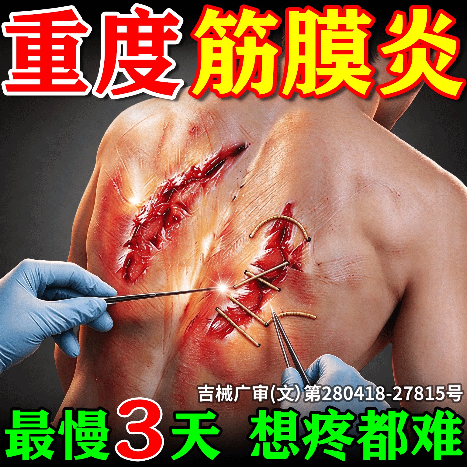 后背筋膜炎专用膏药贴效肩胛骨缝背部疼痛肌肉拉伤劳损特热敷神器