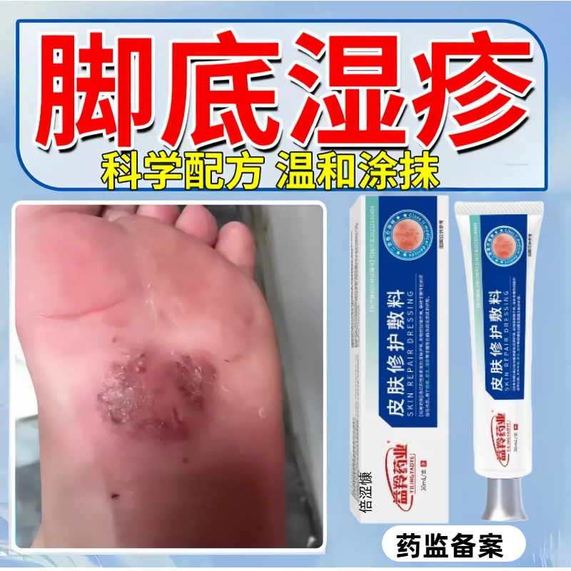 脚底湿疹真菌感染止痒脚气脚癣水泡瘙痒脚部去脚上脚背慢性湿疹lm