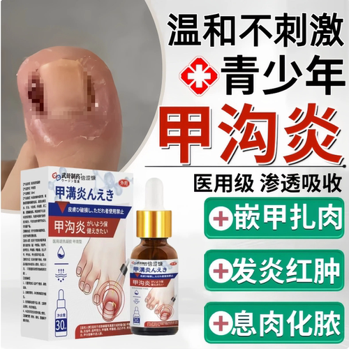 甲沟炎矫正息肉化消炎化脓青少年