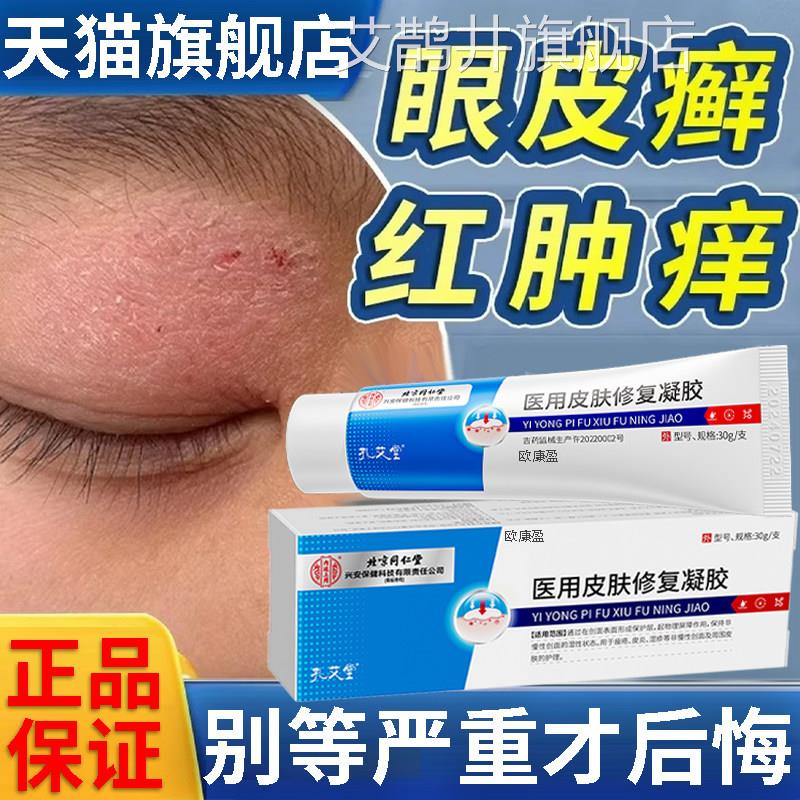 眼皮癣神经皮炎眼皮红肿痒眼睛周围干燥起皮眼角发痒掉屑过性敏HX