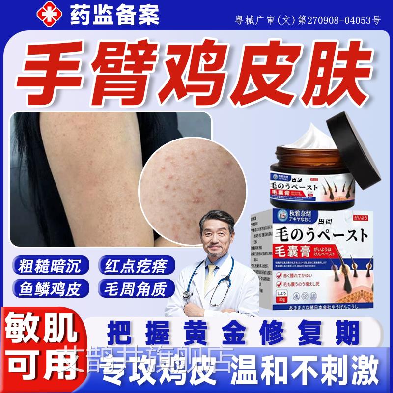 手臂鸡皮肤毛囊角化症药膏毛囊炎胳上长疙瘩去除脖颈儿膊童毛周gx