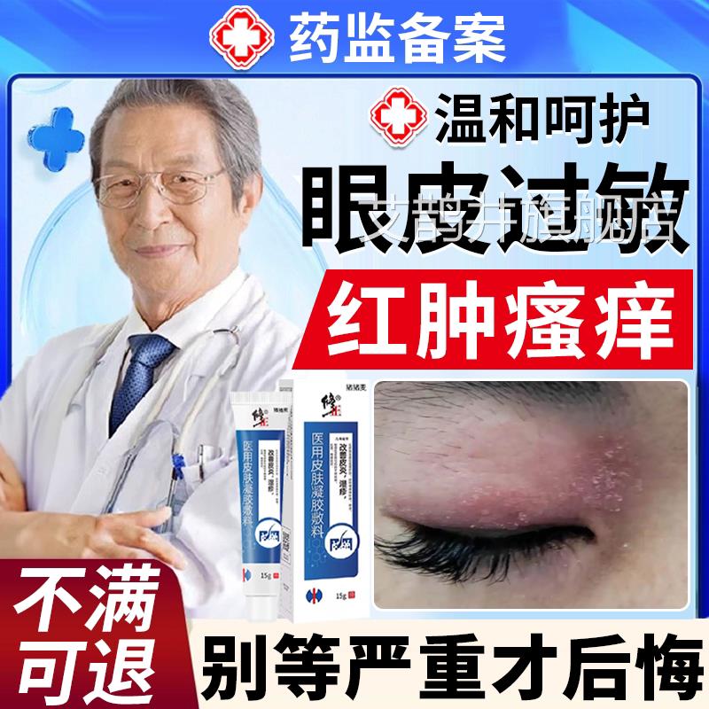眼皮癣红肿痒眼睛周围过敏眼痒干燥起皮掉屑神经性皮炎止角痒膏BS