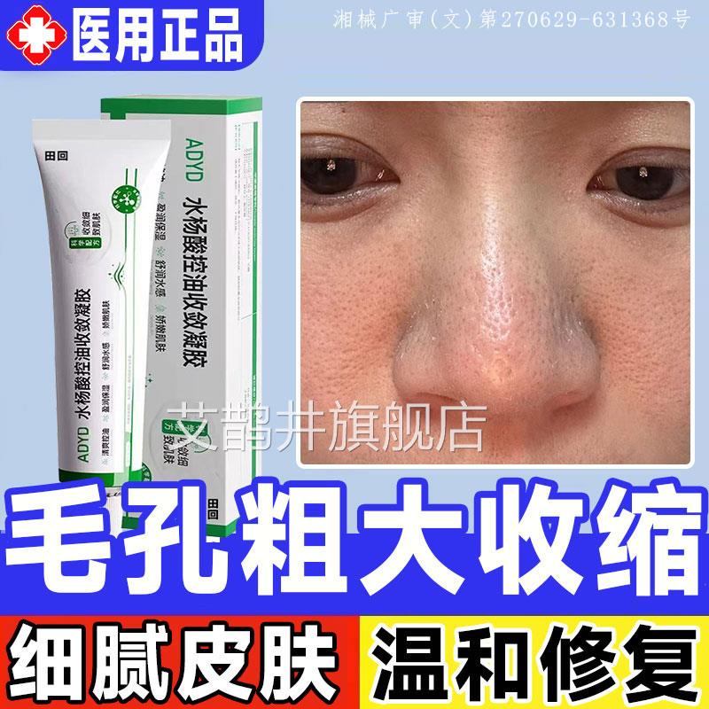脸颊鼻头毛孔粗大收缩修复官方旗舰店药医膏用型水杨酸细致凝胶GX
