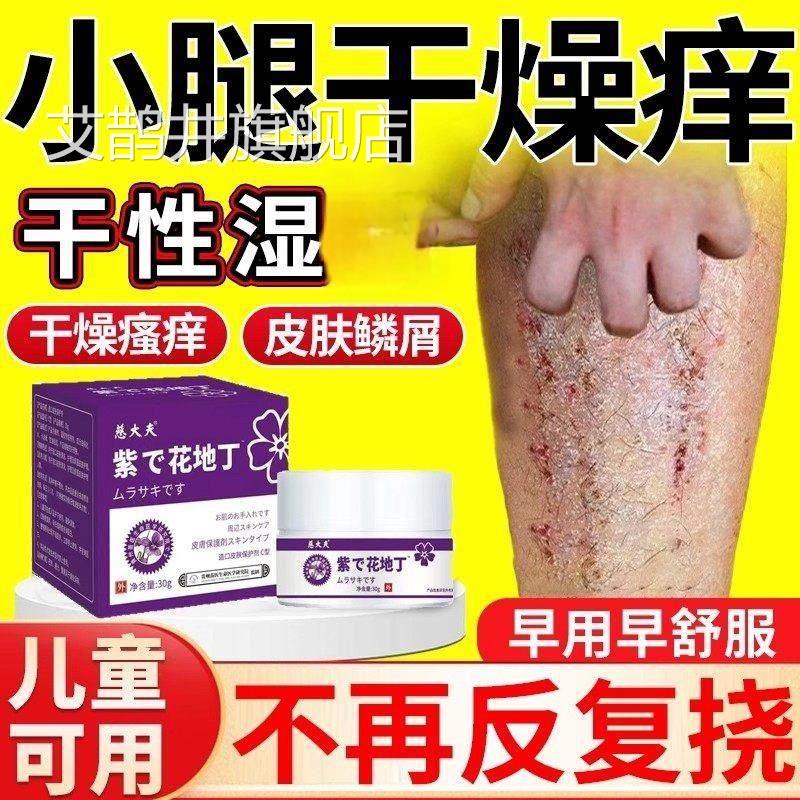 皮肤干燥瘙痒止痒膏抑菌膏补保湿冬天小腿痒水干性湿痒艾鹊井旗舰