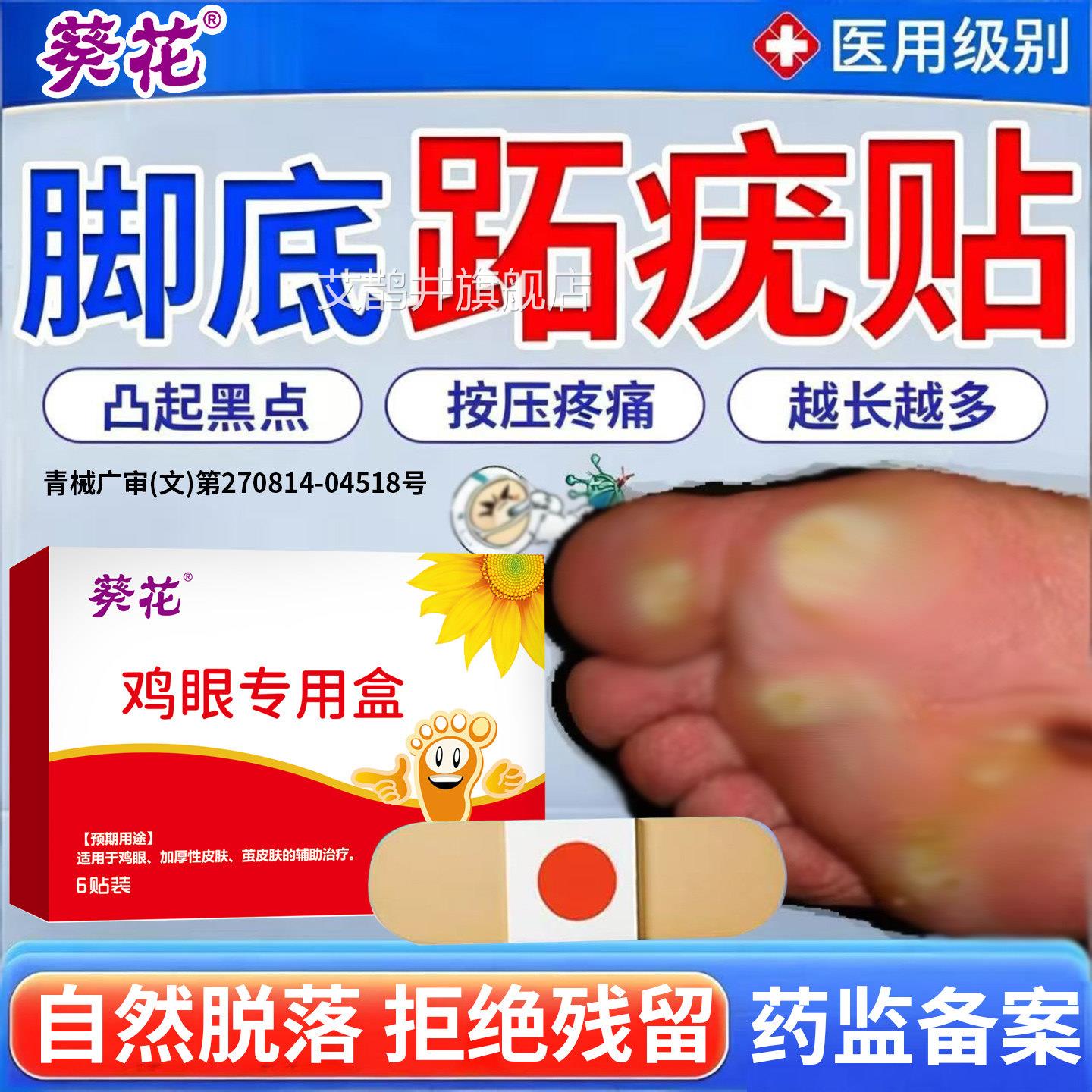 跖疣药膏去脚上除长硬疙瘩祛趾足部脚底连病毒根去疣拔刺猴神器贴