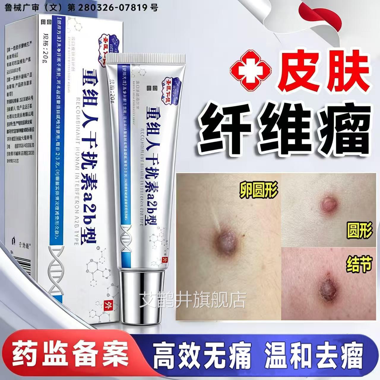 下皮肤纤维瘤去除药膏硬块疙瘩结节皮肿硬块脂肪消瘤医用贴神器LT