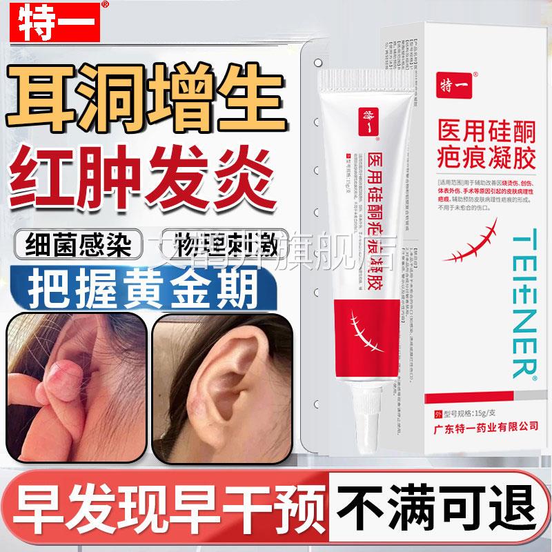 去耳洞增生硅酮疤痕复除疤第修凝胶膏一名凸起硬肉疙瘩旗舰店正品