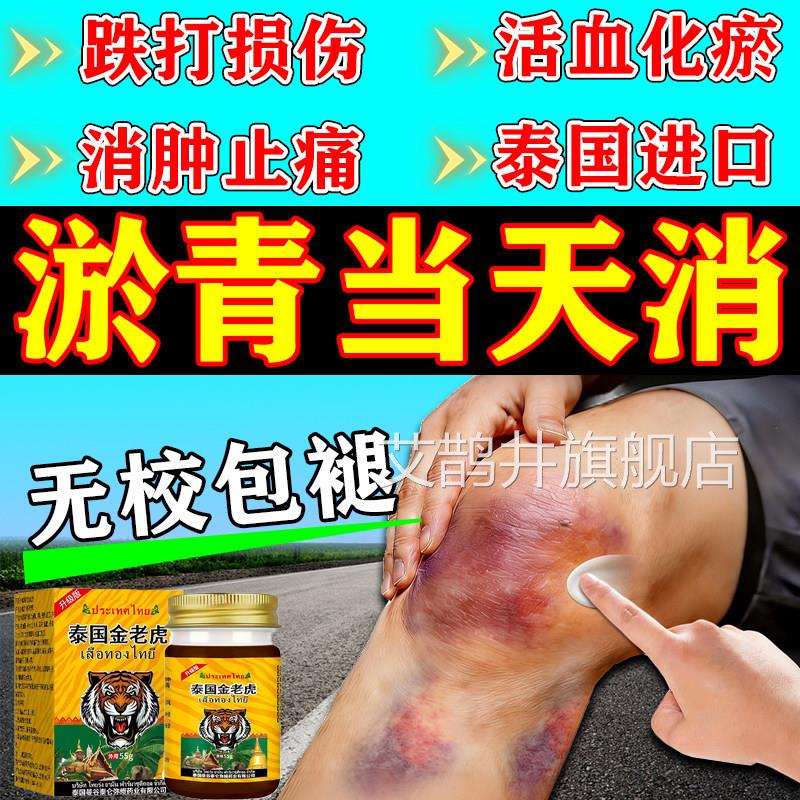 淤青膏速消除活血化瘀儿童跌打损伤磕摔撞伤发紫消红肿止快痛专用